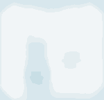 Ergebnisse der Nutzenbewertung von Orphan Drugs. Eine ausführliche Beschreibung der Grafik finden Sie unter dem Link, der auf die Grafik folgt.