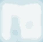 Ergebnisse der Nutzenbewertung von Orphan Drugs. Eine ausführliche Beschreibung der Grafik finden Sie unter dem Link, der auf die Grafik folgt.